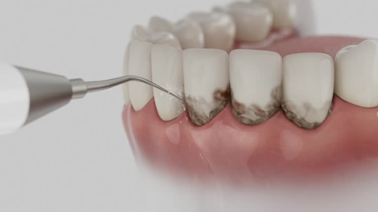 Trusted Root Canal Treatment service in Fort Hood, TX - Dentist Open Now